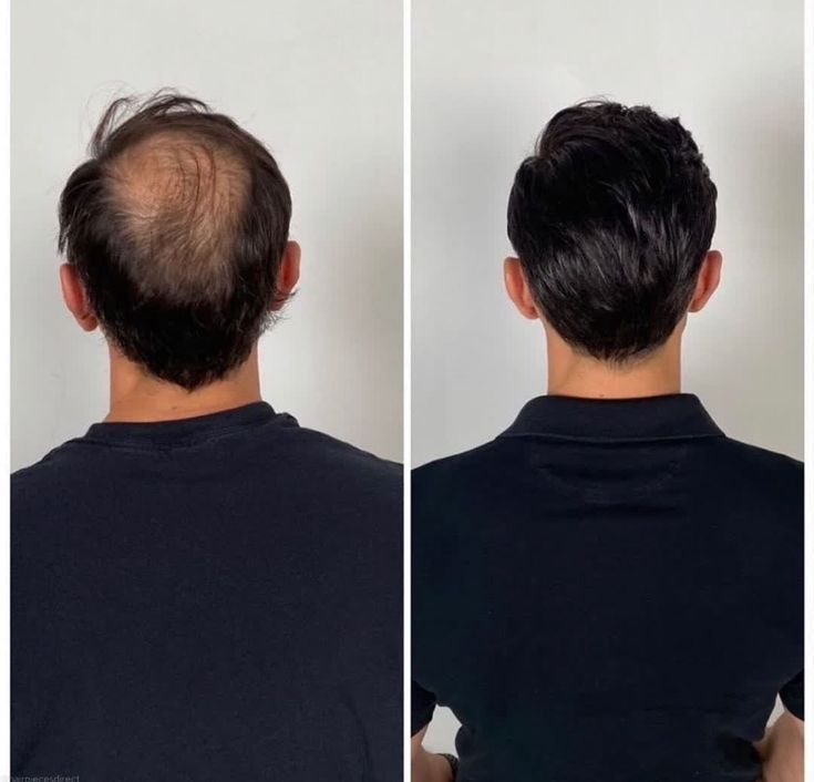 Men's